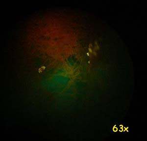 Cristalli di UranoCircite sospesi nella polvere e catturati dal filtro. Microscopio a fluorescenza  460nm.