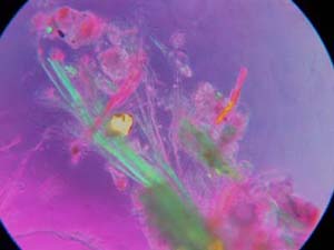 Il microscopio polarizzatore ci mostra un delicato spettacolo di fibre multicolori che rendono l'immagine simile ad un quadro astratto. Notare le fibre ortogonali con il colore invertito.