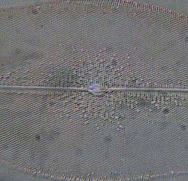 Pleurosigma angulatum: Ob. 40x 0,65 a.n..