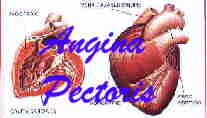 angina pectoris