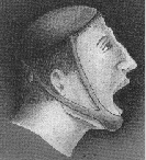 Mentoniera.